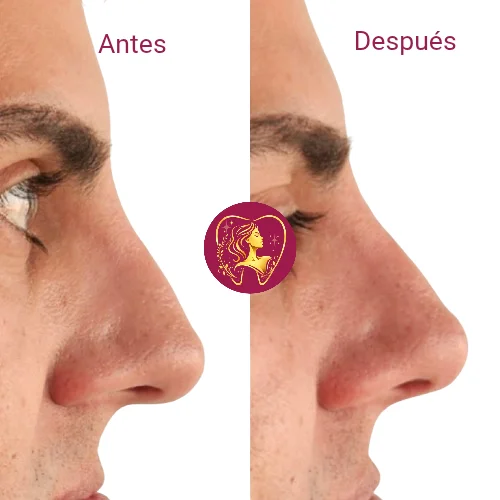 Antes y después 3