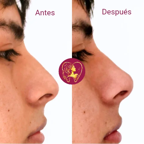 Antes y después 2